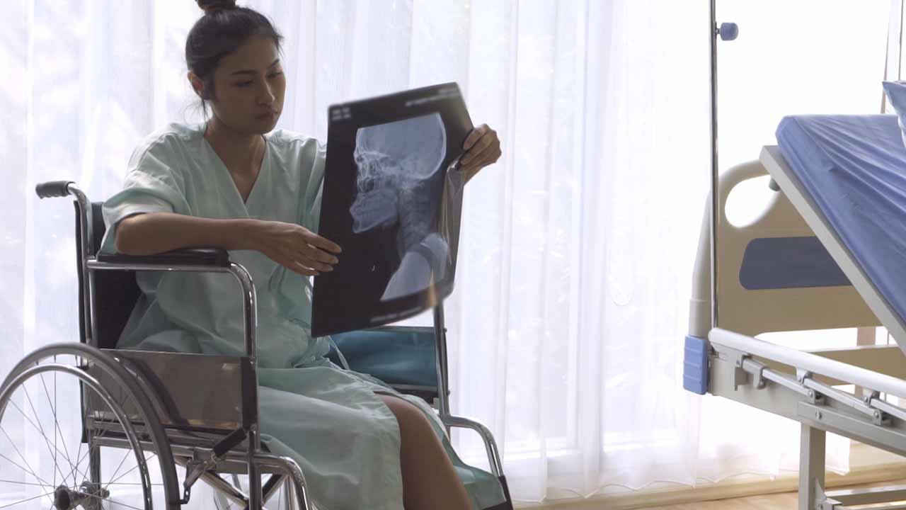 Woman in wheelchair looking at an x-ray